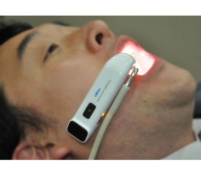 Dentozone eBite (Electronic Bite) - беспроводная система интраоральной подсветки и аспирации