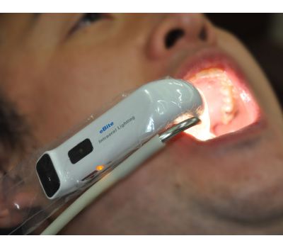 Dentozone eBite (Electronic Bite) - беспроводная система интраоральной подсветки и аспирации
