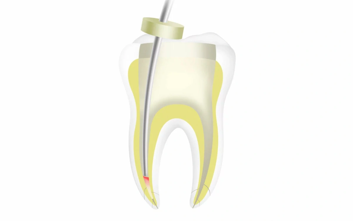 Fi-P канал.jpg.jpeg