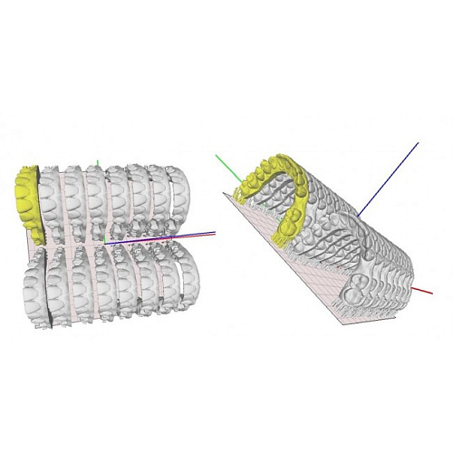 Omaker Basic (Dental) - профессиональный 3D-принтер для стоматологии