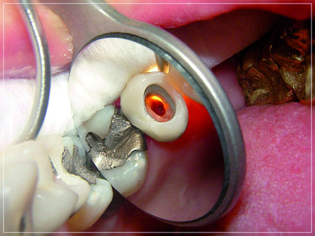 Hahnenkratt Mega FS 4 — Зеркала родиевые №4, упаковка 12 шт