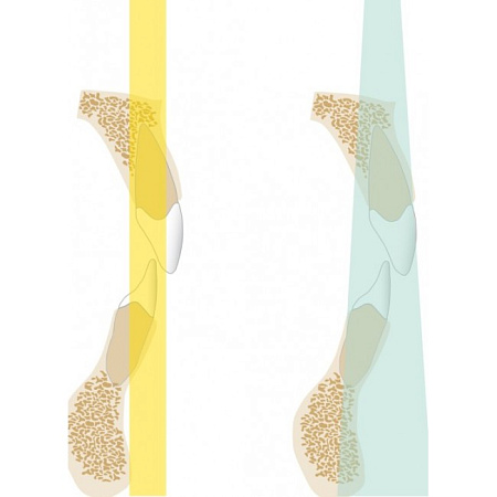 KaVo Pan eXam Plus 3D Ceph (2 датчика) - универсальный датчик Pan/Ceph для панорамной томографии, цефалостат, функция 3D-томографии 6x8 см