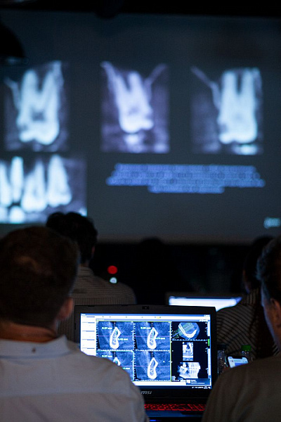 Юрия Седова- «Конусно-лучевая компьютерная томография в практике врача-стоматолога»_10a.jpg