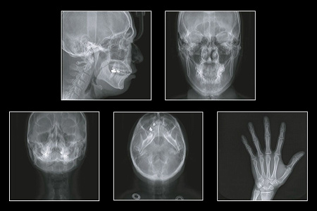 GENORAY Papaya 3D Plus 16x8 - компьютерный томограф с цефалостатом