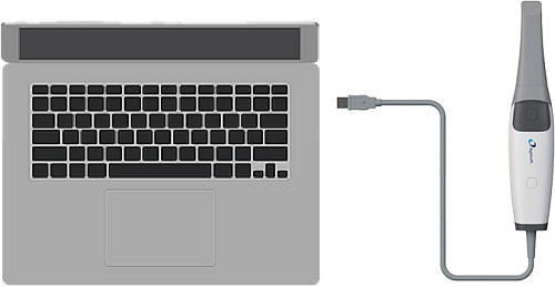 Eighteeth Helios 600 — Интраоральный сканер