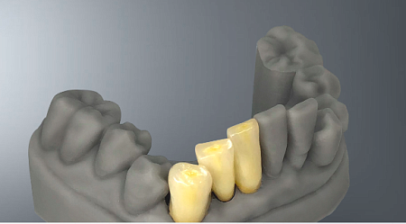 Veltz D2-120 - Высокоточный 3D Принтер 