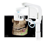 Дентальные томографы, купить в GREEN DENT, акции и специальные цены. 